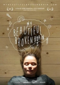 Постер: Мой прекрасный сломанный мозг / My Beautiful Broken Brain (2014)